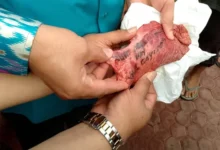 Misteri Nama di Paru Sapi Kurban: Benarkah Tulisan Ini?