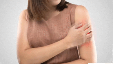 Obat Terkena Bahan Kimia? Atasi Cepat Dengan Pertolongan Pertama Ini