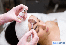 Rahasia Kulit Bebas Jerawat? Acne Peeling Jawabannya!